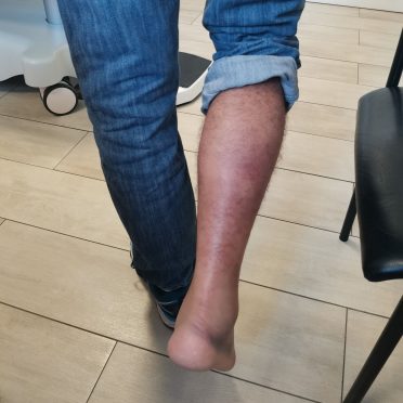 Les blessures du deuil